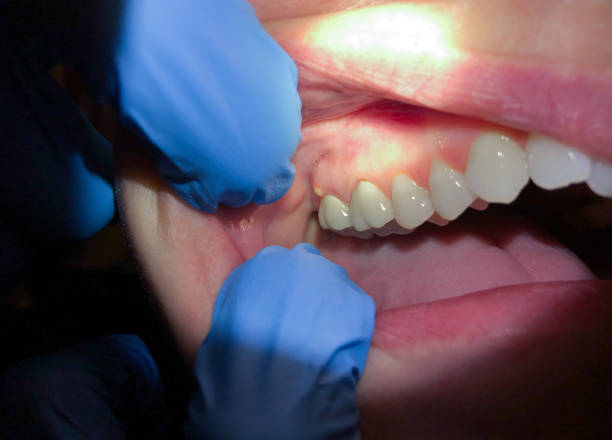 Best Emergency Cosmetic Dentistry in Carrollton, GA